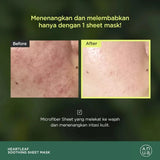 ANUA Heartleaf 77% Soothing Sheet Mask (1ea)