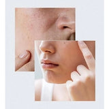 Anua Birch Moisture Boosting Serum