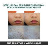 P. CALM Sensitive Skin UnderPore Foam Cleanser 250ml
