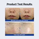 P.CALM LIGHT ACTIVE MASK PACK 25ml (1ea)