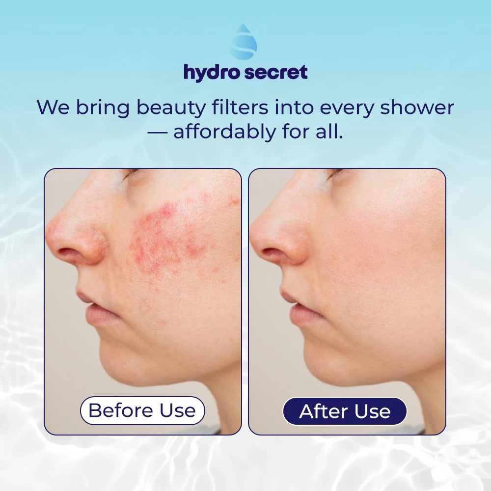 [KIT] Hydro Secret Shower Filter Kit