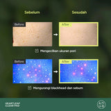 ANUA Heartleaf Clear Pad 2EA Anti Jerawat & Komedo