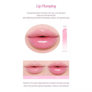 YNM Ultimate Lip Plumper