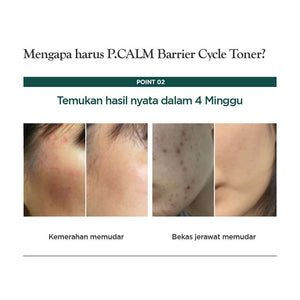 P.CALM Barrier Cycle Toner 30ml