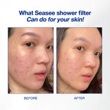 [All Variant] SEASEE Rain Shower Filter Kit