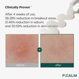 P.CALM Centella Trouble Spot 15ml