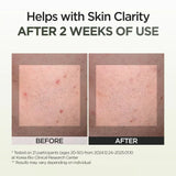 P.CALM 9 Seaweed Spot Correcting Serum 30ml