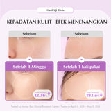 EQQUALBERRY-PURPLE PDRN PORE MINIMIZING SERUM 30ml