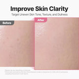 P.CALM Red Rice Glow Peel Shot 8 Serum