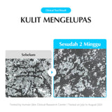 EQQUALBERRY Swimming Pool Toner 155ml & 300ml Hydrating Wajah